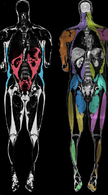 Beyond Diagnostics – The Added Value of Digital Body Imaging