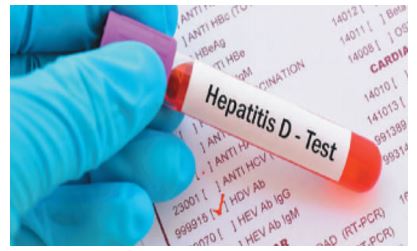 FDA Guidance on Less Common Viral Hepatitis Type